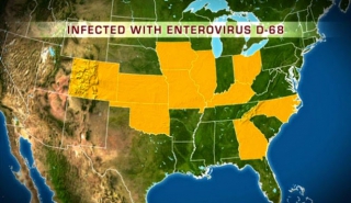 EV-D68:ο εντεροϊός που σήμανε συναγερμό σε ΗΠΑ και Καναδά και παρουσιάστηκε μόνο σε εμβολιασμένα παιδιά